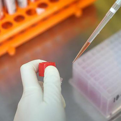 Geregistreerd Ce van de Testkit colloidal gold van IgM IgG van het Monkeypoxvirus